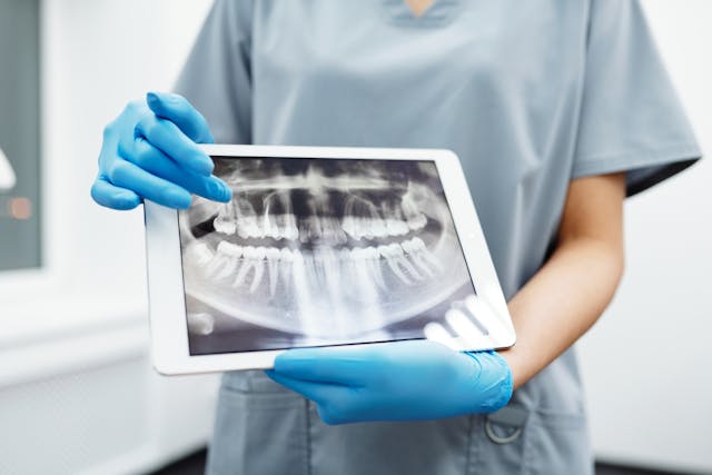 Why You Should See a Root Canal Specialist in NYC